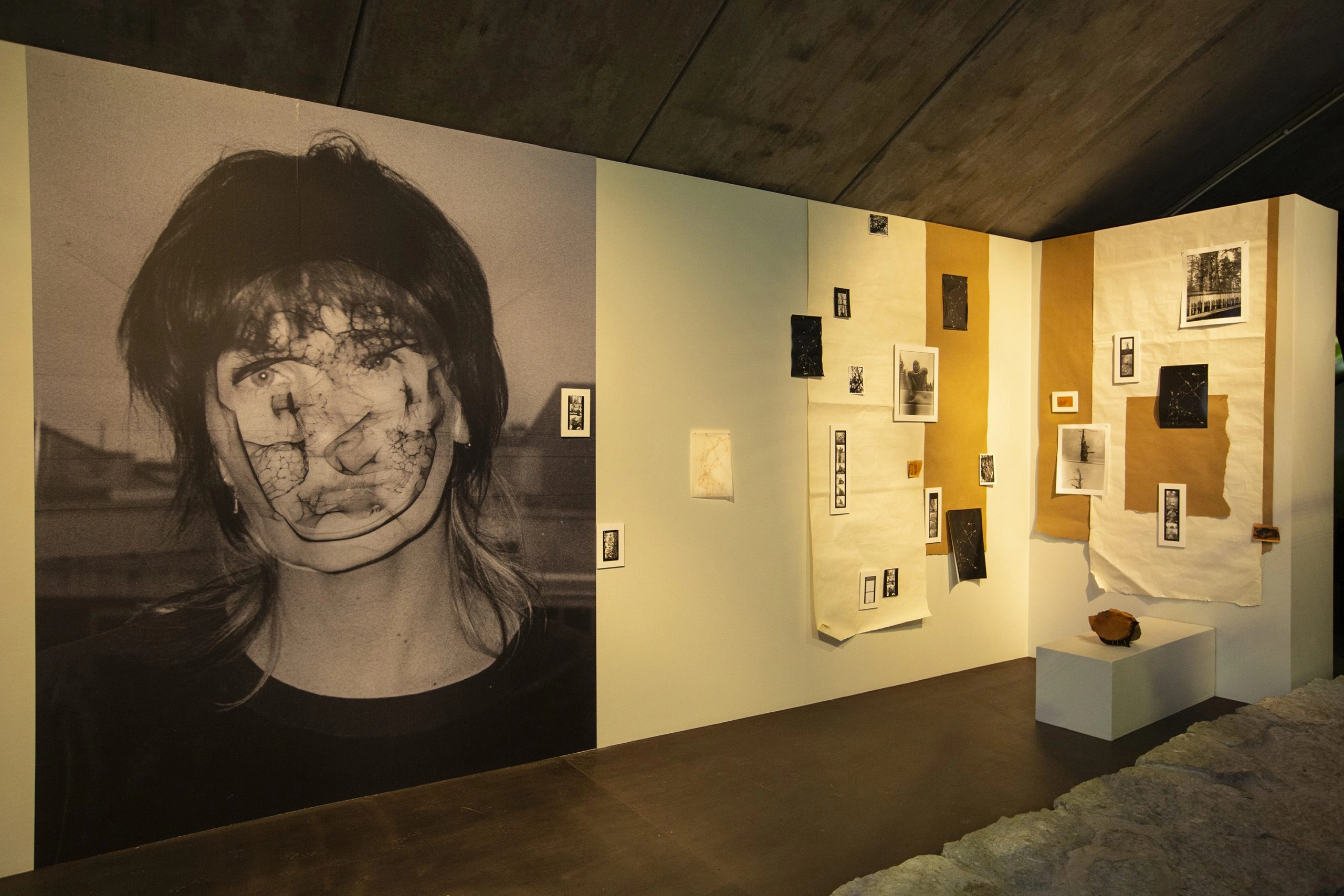 SOO